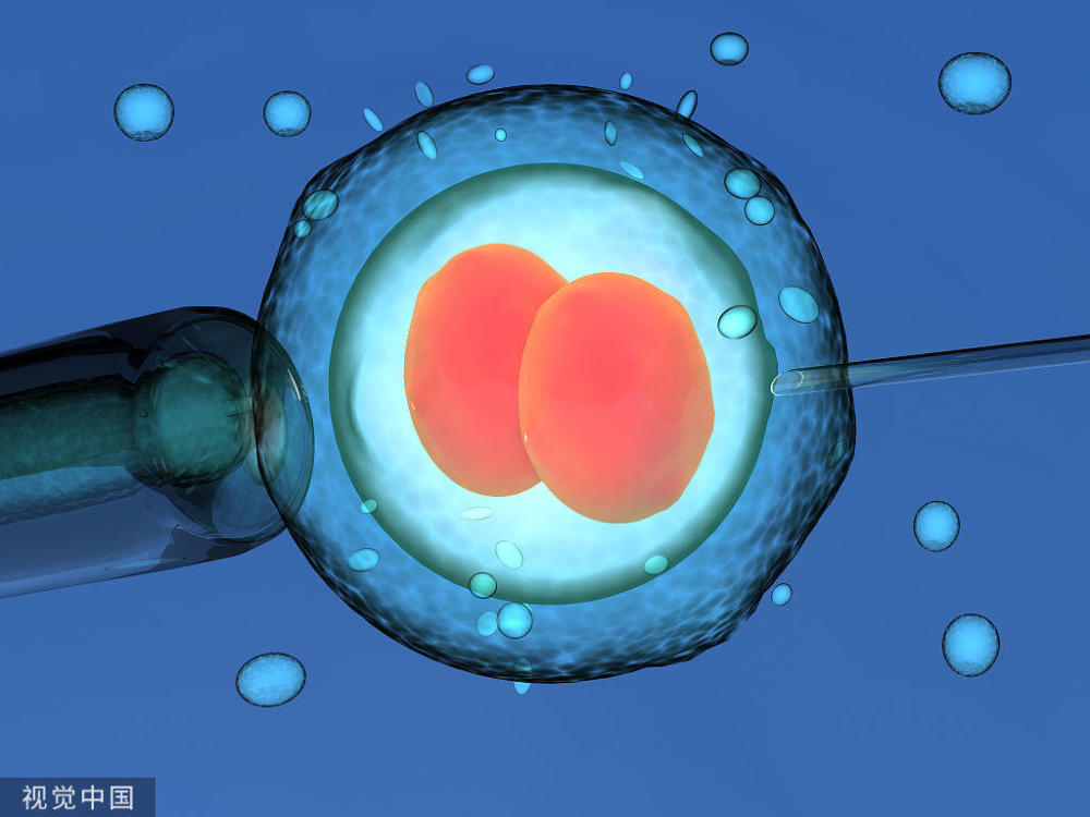 胎儿染色体微阵列分析